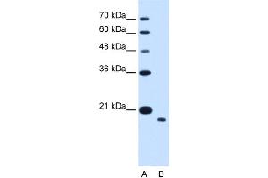 WB Suggested Anti-TMEM91 Antibody Titration:  1. (TMEM91 anticorps  (N-Term))