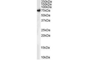Image no. 1 for anti-Syntaxin Binding Protein 1 (STXBP1) (C-Term) antibody (ABIN374370) (STXBP1 anticorps  (C-Term))