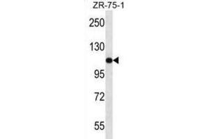 Western Blotting (WB) image for anti-USO1 Homolog, Vesicle Docking Protein (USO1) antibody (ABIN2997687) (USO1 anticorps)