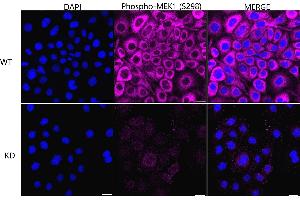Immunocytochemical staining of HeLa cells using Phospho-MEK1 (S298) antibody (ABIN7799462), 1:1,000), Top panel: wild-type (WT), Bottom panal: Phospho-MEK1 (S298) shRNA knockdown (KD). (Recombinant MEK1 anticorps  (pSer298))