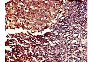 Immunohistochemistry of paraffin-embedded human tonsil tissue using ABIN7150681 at dilution of 1:100 (PDE11A anticorps  (AA 42-190))