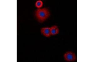 Immunofluorescent analysis of CLIP3 staining in A549 cells.