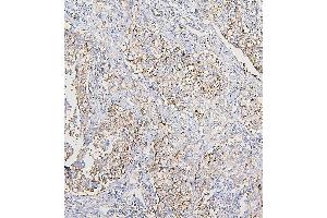 IHC analysis of COPE using anti-COPE antibody (ABIN7602509). (COPE anticorps  (AA 80-308))