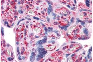 Human Placenta: Formalin-Fixed, Paraffin-Embedded (FFPE)