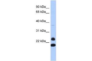 WB Suggested Anti-NEUROG2 Antibody Titration:  0. (Neurogenin 2 anticorps  (N-Term))