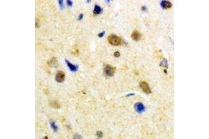 Immunohistochemical analysis of S100-A1 staining in human brain formalin fixed paraffin embedded tissue section. (S100A1 anticorps)
