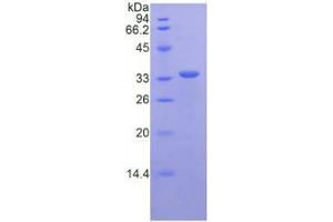 SDS-PAGE analysis of Mouse CD163 Protein. (CD163 Protein (CD163))