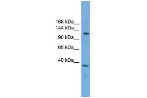 WB Suggested Anti-EIF4ENIF1 Antibody Titration: 0. (EIF4ENIF1 anticorps  (N-Term))