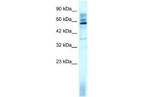 WB Suggested Anti-TAF15 Antibody Titration: 3. (TAF15 anticorps  (N-Term))