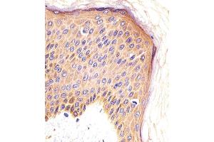 Paraformaldehyde-fixed, paraffin embedded human skin tissue, Antigen retrieval by boiling in sodium citrate buffer (pH6.