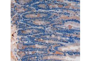 IHC-P analysis of Rat Intestine Tissue, with DAB staining. (SIRT2 anticorps  (AA 28-303))