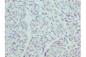 Immunohistochemistry of paraffin-embedded human pancreatic tissue using ABIN7145930 at dilution of 1:100 (CCR4 anticorps  (AA 309-360))