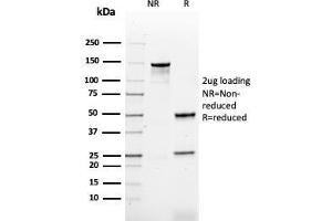 SDS-PAGE Analysis Purified HPV-16 Mouse Recombinant Monoclonal Antibody (rHPV16L1/1058). (Recombinant HPV16 anticorps)
