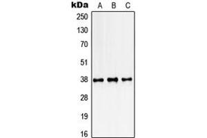 Western blot analysis of SSBP2 expression in K562 (A), NIH3T3 (B), rat kidney (C) whole cell lysates. (SSBP2 anticorps  (N-Term))