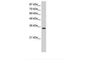 Image no. 2 for anti-Muscleblind-like Protein 1 (MBNL1) (AA 211-260) antibody (ABIN6736245) (MBNL1 anticorps  (AA 211-260))