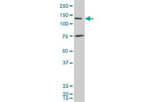JMY polyclonal antibody (A01), Lot # 060717JCS1 Western Blot analysis of JMY expression in Y-79 .