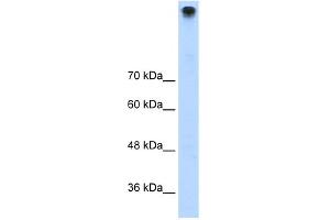 WB Suggested Anti-TRPM3 Antibody Titration:  1. (TRPM3 anticorps  (N-Term))