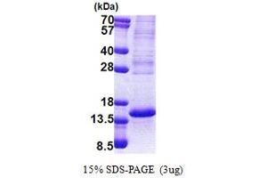 SDS-PAGE (SDS) image for P53-Regulated Apoptosis-Inducing Protein 1 (TP53AIP1) (AA 1-124) protein (His tag) (ABIN5853177) (TP53AIP1 Protein (AA 1-124) (His tag))