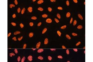 Immunofluorescence analysis of U20S cells using CHD4 Polyclonal Antibody at dilution of 1:100.