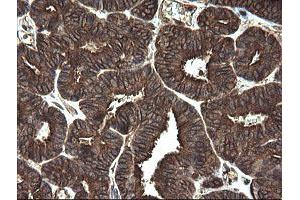 Image no. 1 for anti-Receptor Accessory Protein 5 (REEP5) antibody (ABIN1500659)