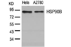 Image no. 3 for anti-Heat Shock Protein 90kDa alpha (Cytosolic), Class B Member 1 (HSP90AB1) (Ser254) antibody (ABIN197569) (HSP90AB1 anticorps  (Ser254))
