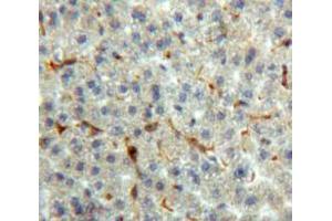 Used in DAB staining on fromalin fixed paraffin-embedded Liver tissue