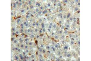 Used in DAB staining on fromalin fixed paraffin-embedded Liver tissue (Prothrombin anticorps  (AA 44-198))