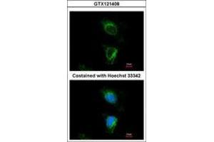 Image no. 3 for anti-Dihydrouridine Synthase 2-Like (DUS2L) (AA 1-199) antibody (ABIN1497929) (DUSL2 anticorps  (AA 1-199))