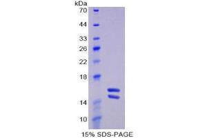 SDS-PAGE (SDS) image for Interleukin 23, alpha subunit p19 (IL23A) (AA 20-189) protein (His tag) (ABIN1877359)