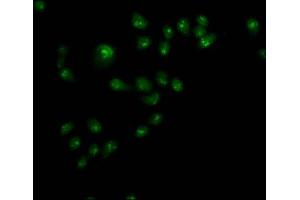 Immunofluorescence staining of Hela cells with ABIN7144542 at 1:110,counter-stained with DAPI. (ALOX5 anticorps  (AA 2-149))
