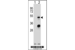 Western blot analysis of HAT1 using rabbit polyclonal HAT1 Antibody using 293 cell lysates (2 ug/lane) either nontransfected (Lane 1) or transiently transfected (Lane 2) with the HAT1 gene. (HAT1 anticorps  (N-Term))