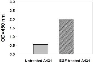 Image no. 1 for Signal Transducer and Activator of Transcription 5A (STAT5A) ELISA Kit (ABIN1981730)