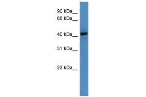 WB Suggested Anti-RNF128 Antibody Titration: 0. (RNF128 anticorps  (C-Term))