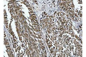 IHC analysis of TRMT10C using anti-TRMT10C antibody (ABIN7601472).