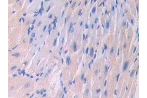 Used in DAB staining on fromalin fixed paraffin- embedded liver tissue (IL18RAP anticorps  (AA 396-548))