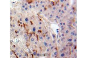 Used in DAB staining on fromalin fixed paraffin-embedded Liver tissue (ADCY4 anticorps  (AA 352-541))