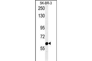 Western blot analysis in SK-BR-3 cell line lysates (15ug/lane). (Radil anticorps  (C-Term))