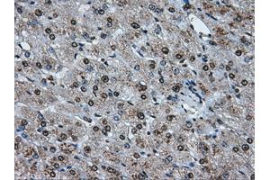 Image no. 16 for anti-ATP Synthase, H+ Transporting, Mitochondrial F1 Complex, beta Polypeptide (ATP5B) antibody (ABIN1496766)