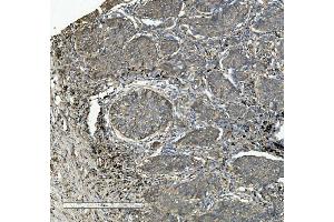 IHC analysis of Integrin beta 5/ITGB5 using anti-Integrin beta 5/ITGB5 antibody (ABIN7601319). (Integrin beta 5 anticorps  (AA 32-689))