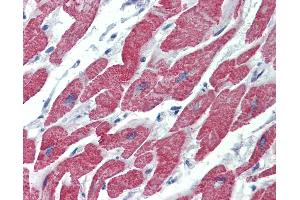 Anti-ALK-1 antibody IHC of human heart.