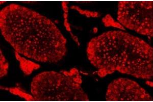 IF analysis of SAE1 using anti-SAE1 antibody (ABIN7601346). (SAE1 anticorps  (AA 33-299))