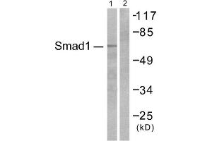 Western blot analysis of extracts from COS7 cells, treated with EGF (200ng/ml, 15mins), using Smad1 (epitope around residue 465) antibody.