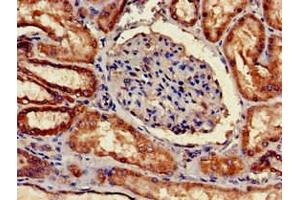 Immunohistochemistry of paraffin-embedded human kidney tissue using ABIN7148332 at dilution of 1:100 (C1QA anticorps  (AA 26-125))