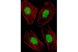 Immunofluorescence (IF) image for anti-Nuclear Receptor Subfamily 1, Group H, Member 3 (NR1H3) antibody (ABIN5024918) (NR1H3 anticorps)