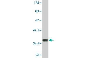 Western Blot detection against Immunogen (33.