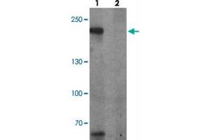 Western blot analysis of TET3 in SK-N-SH cell lysate with TET3 polyclonal antibody  at 1 ug/ml in (1) the absence and (2) the presence of blocking peptide. (TET3 anticorps  (AA 1520-1570))