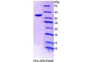 SDS-PAGE analysis of Human TMEM1 Protein. (TRAPPC10 Protéine)