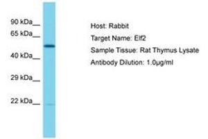 anti-E74-Like Factor 2 (Ets Domain Transcription Factor) (ELF2) (AA 151-200) antibody