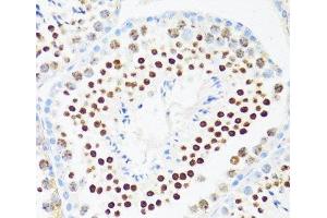 Immunohistochemistry of paraffin-embedded Mouse testis using DDX21 Polyclonal Antibody at dilution of 1:100 (40x lens). (DDX21 anticorps)