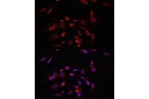 Immunofluorescence analysis of C6 cells using TMEM11 antibody (ABIN7270952) at dilution of 1:100. (TMEM11 anticorps  (AA 1-80))